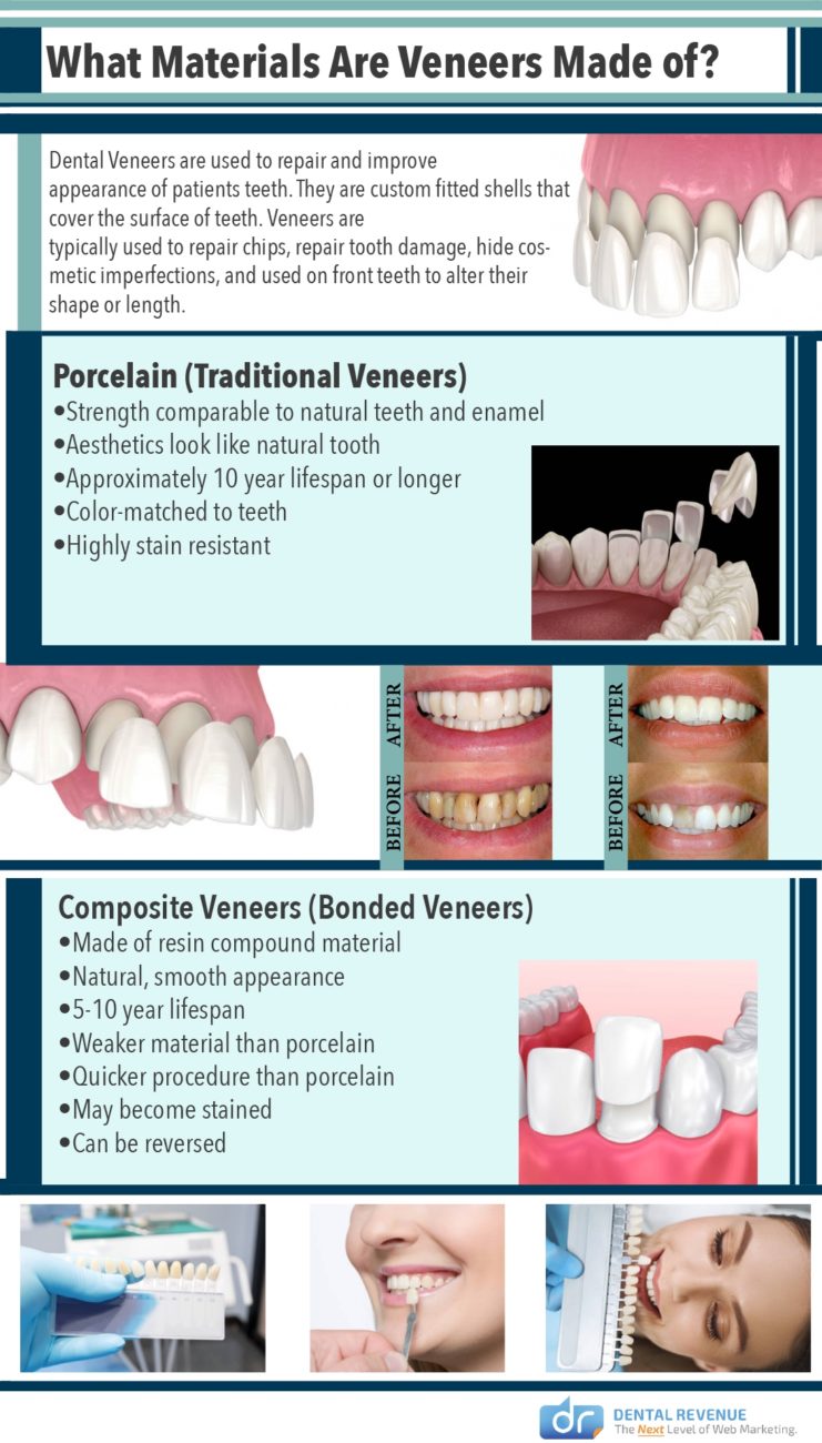 How Much It Cost To Get Your Teeth Fixed